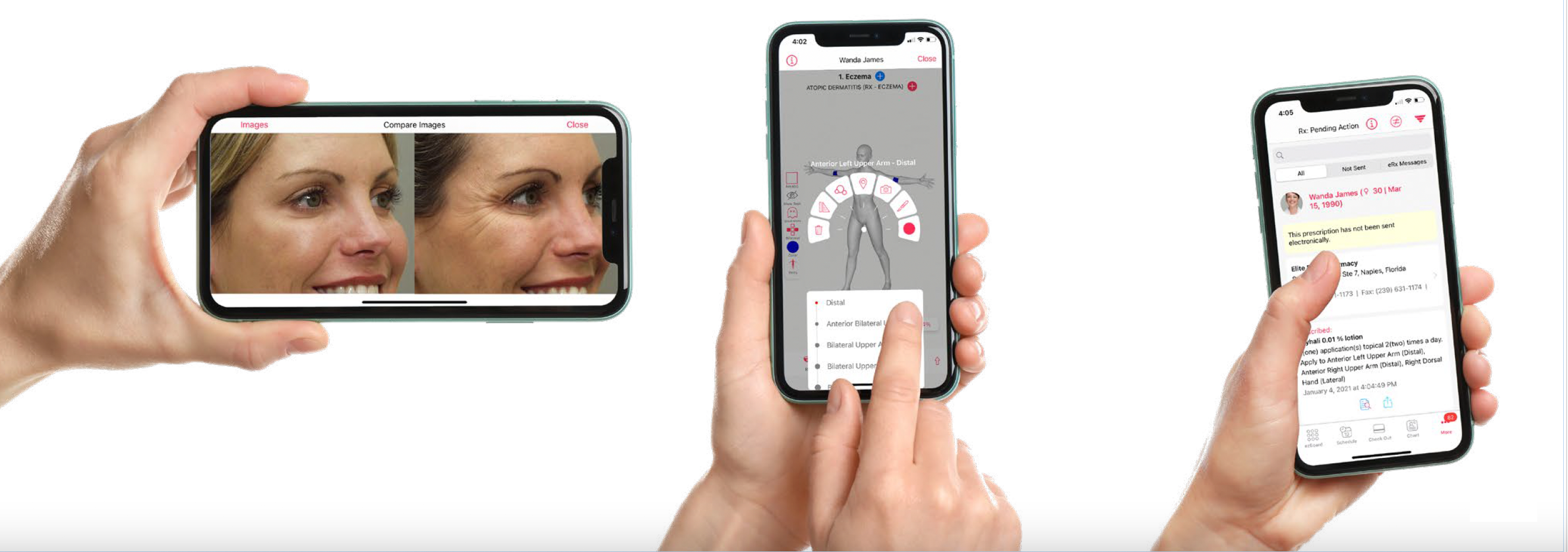 ezderm screenshots phone